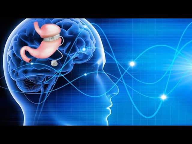 Hypnose pour maigrir, anneau gastrique virtuel